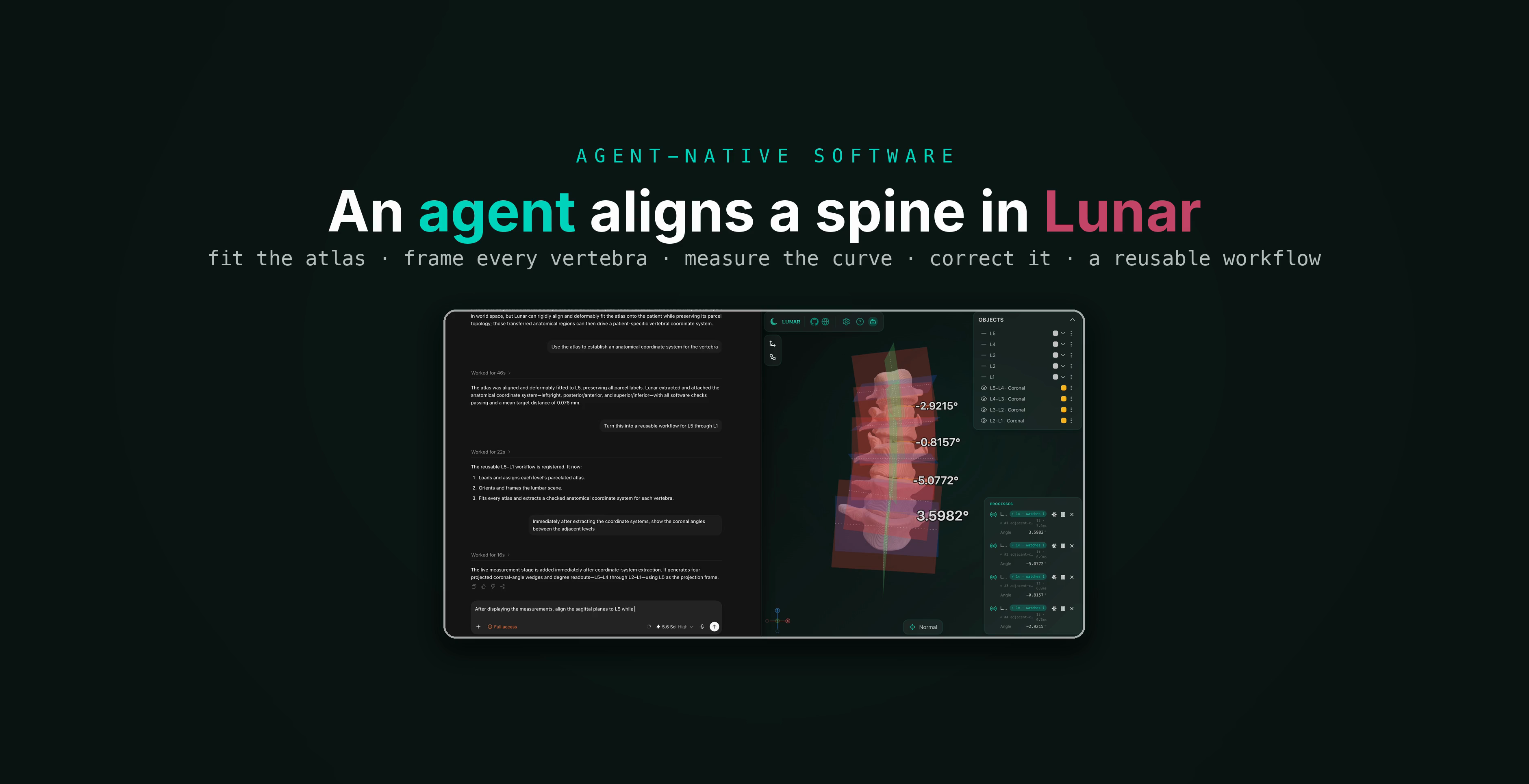 An agent aligns a spine — and builds the tool that does it