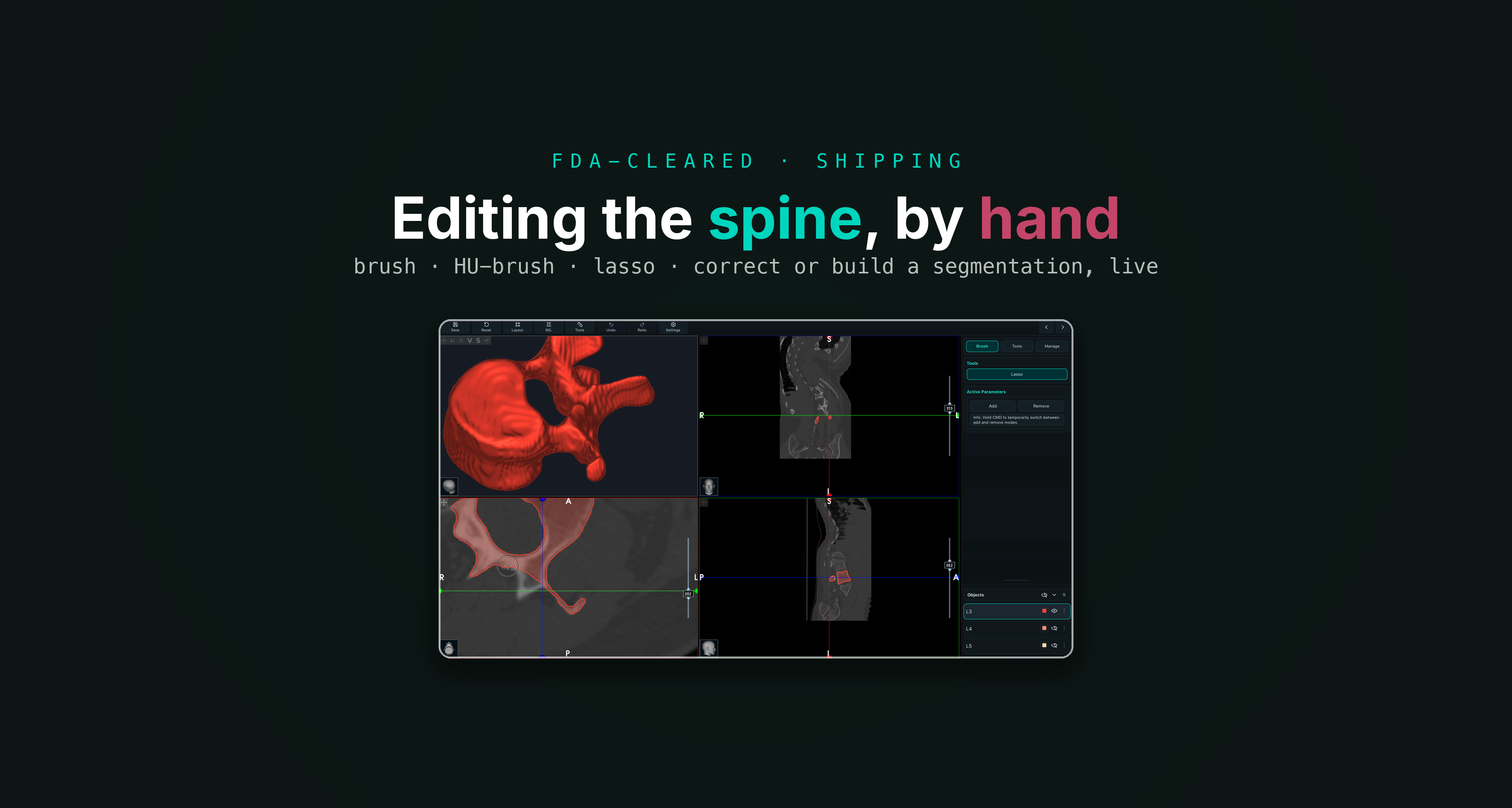 Editing the spine by hand